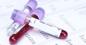 MTD blood test