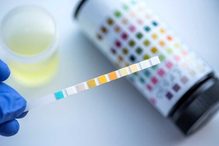 common drug test for employment